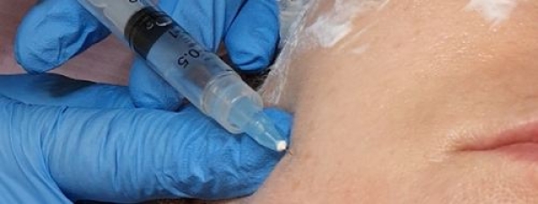 Stymulatory tkankowe